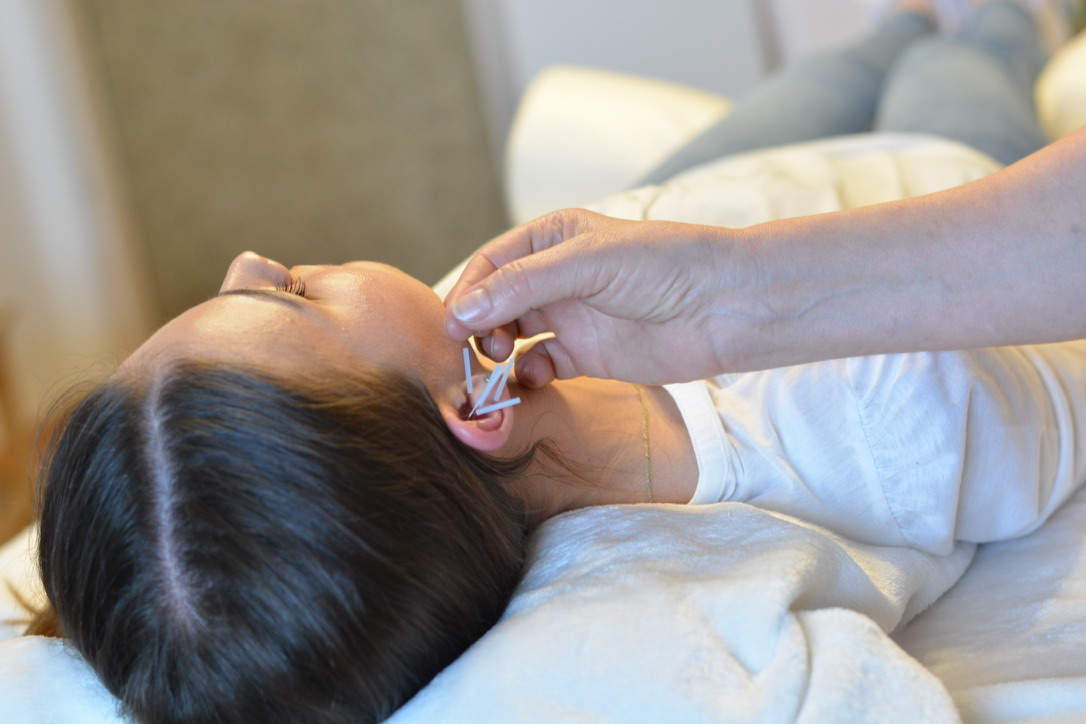 Aurikulotherapie am Ohr